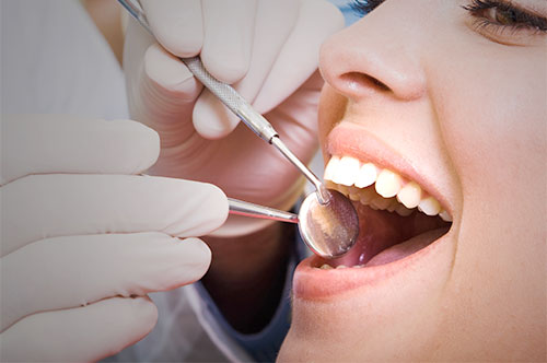 Make a Dental Cleaning Part of Your Spring Plans